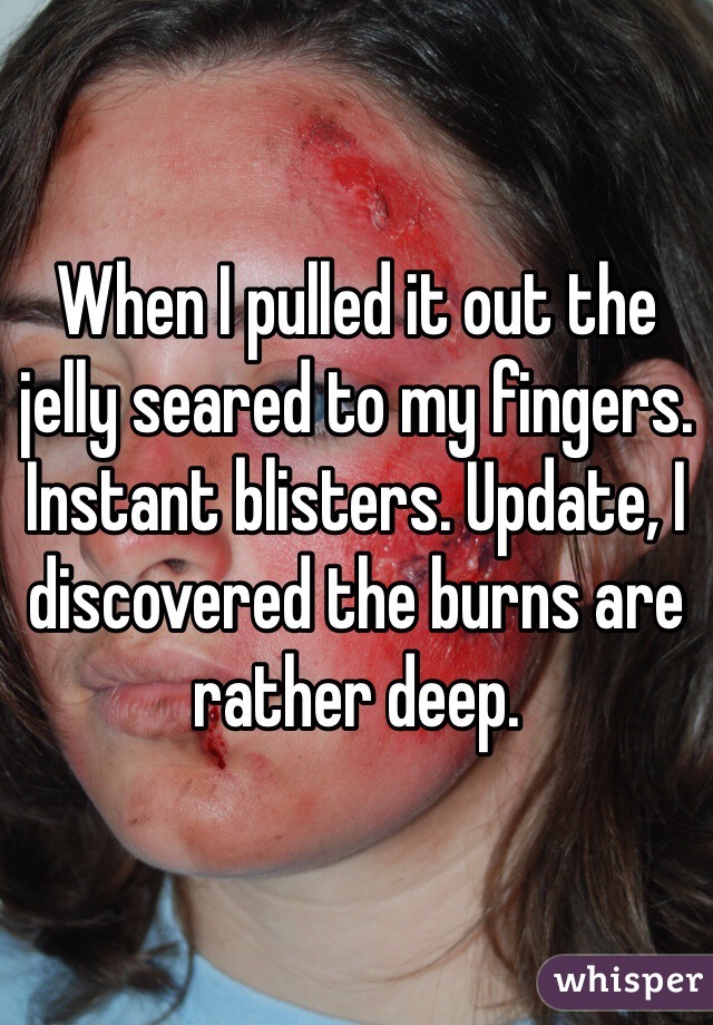 When I pulled it out the jelly seared to my fingers. Instant blisters. Update, I discovered the burns are rather deep.
