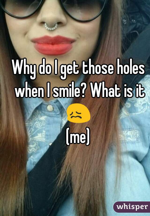 Why do I get those holes when I smile? What is it 😖 
(me)