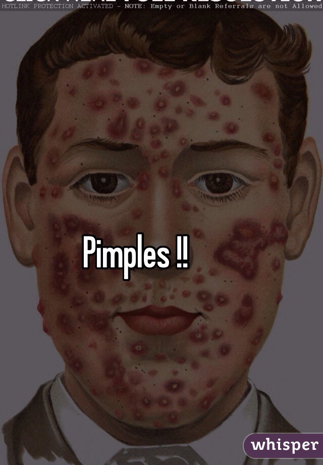 Pimples !!