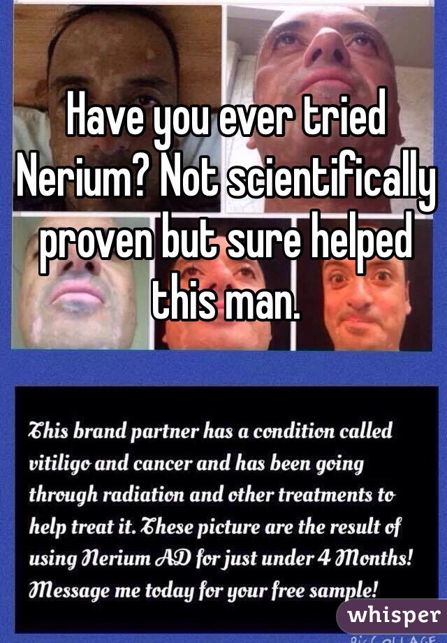 Have you ever tried Nerium? Not scientifically proven but sure helped this man. 