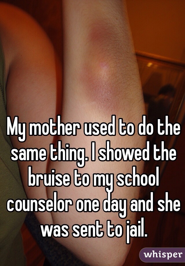 My mother used to do the same thing. I showed the bruise to my school counselor one day and she was sent to jail. 