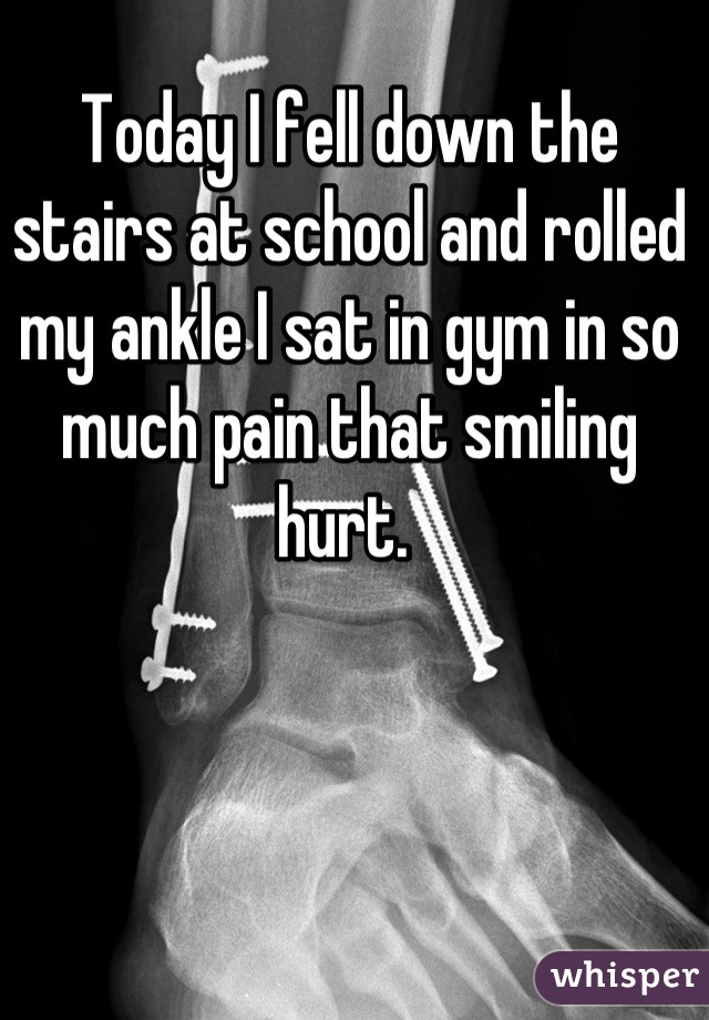 Today I fell down the stairs at school and rolled my ankle I sat in gym in so much pain that smiling hurt. 