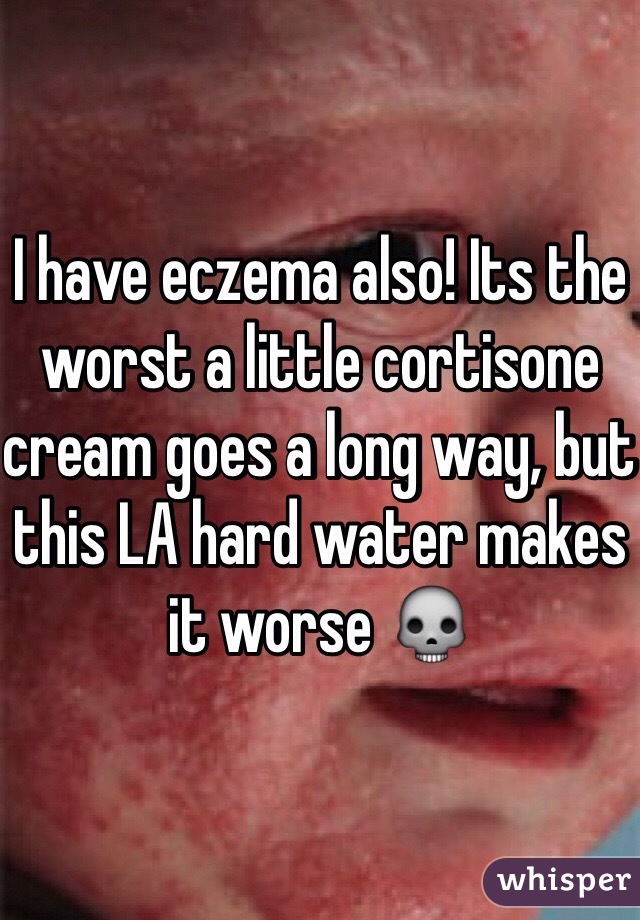 I have eczema also! Its the worst a little cortisone cream goes a long way, but this LA hard water makes it worse 💀