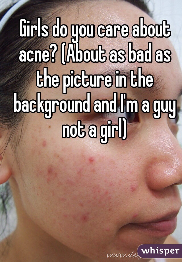 Girls do you care about acne? (About as bad as the picture in the background and I'm a guy not a girl) 