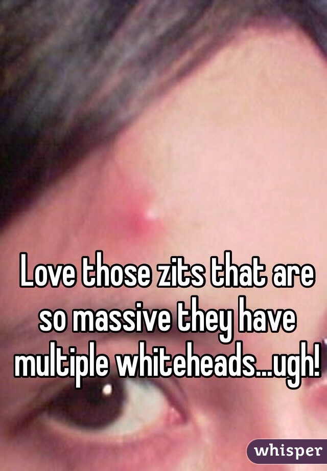 Love those zits that are so massive they have multiple whiteheads...ugh!