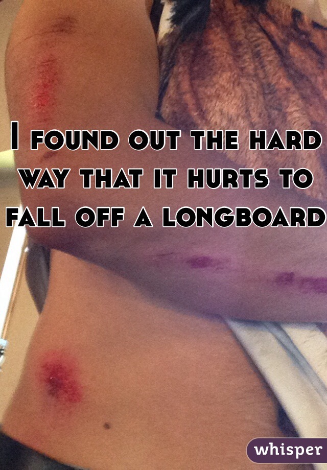 I found out the hard way that it hurts to fall off a longboard