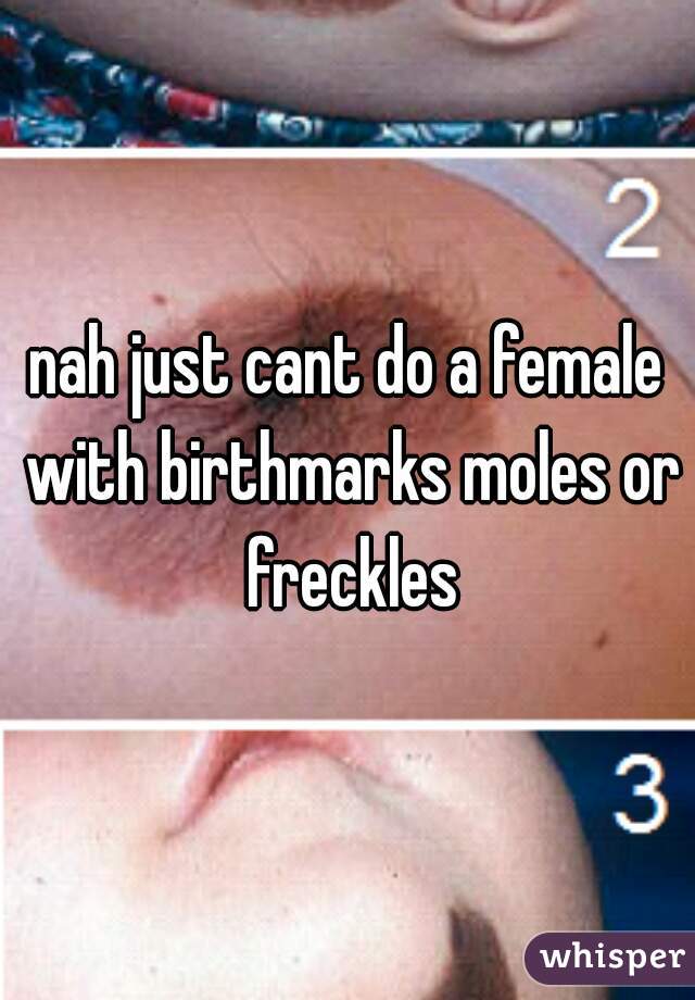 nah just cant do a female with birthmarks moles or freckles