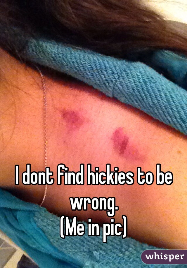 I dont find hickies to be wrong. 
(Me in pic)