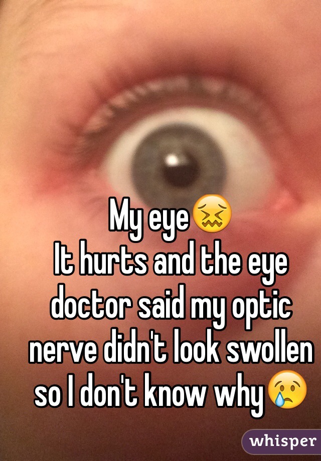 My eye😖
It hurts and the eye doctor said my optic nerve didn't look swollen so I don't know why😢