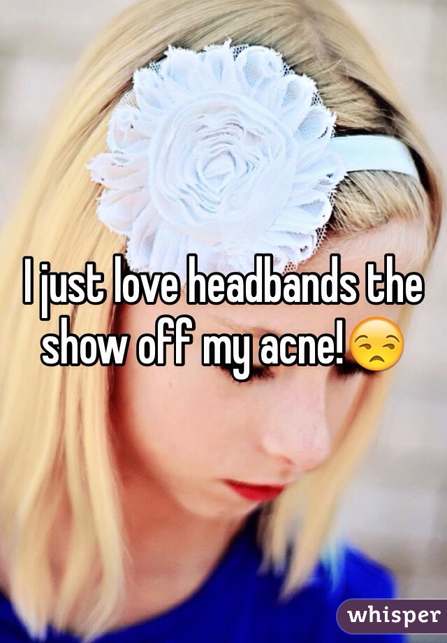 I just love headbands the show off my acne!😒