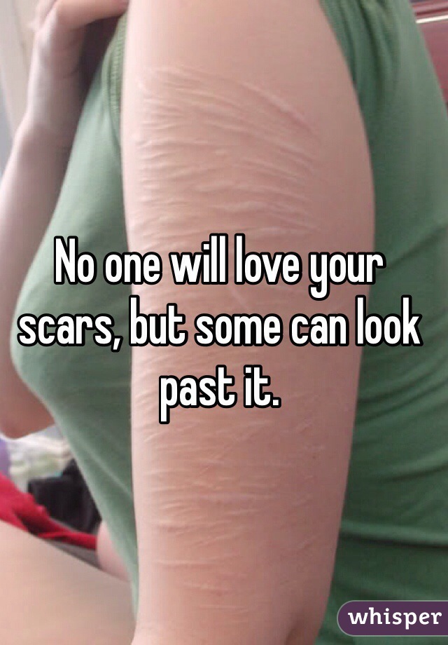 No one will love your scars, but some can look past it. 