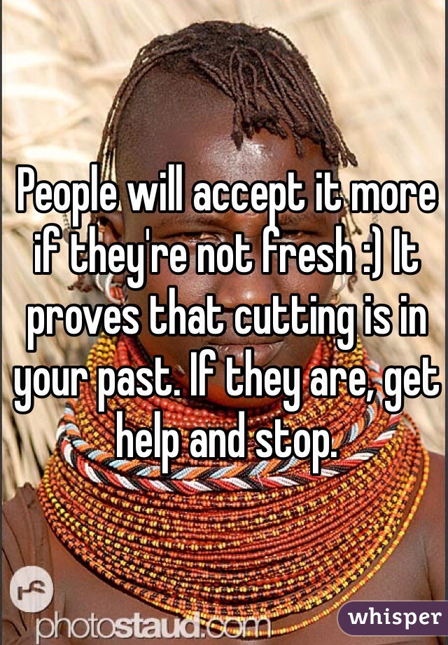 People will accept it more if they're not fresh :) It proves that cutting is in your past. If they are, get help and stop. 