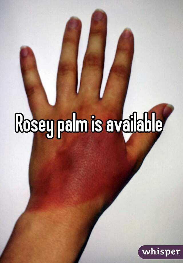 Rosey palm is available 
