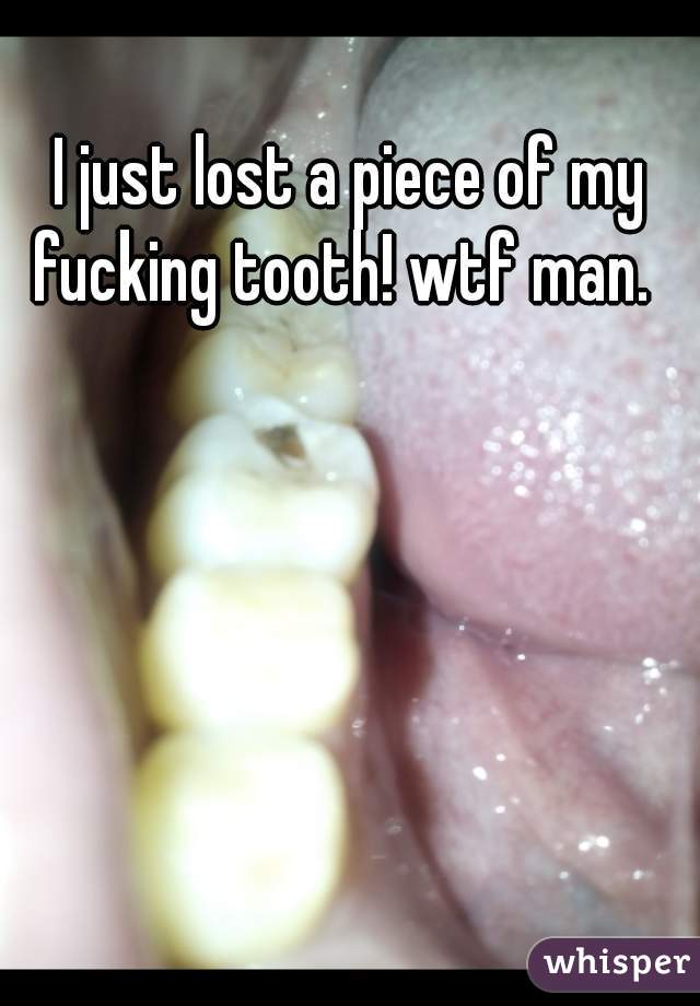 I just lost a piece of my fucking tooth! wtf man.  
