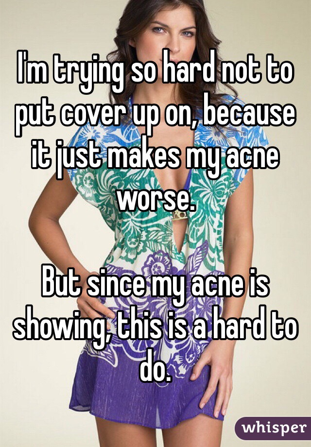 I'm trying so hard not to put cover up on, because it just makes my acne worse. 

But since my acne is showing, this is a hard to do. 
