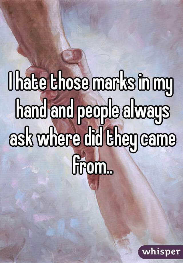 I hate those marks in my hand and people always ask where did they came from..