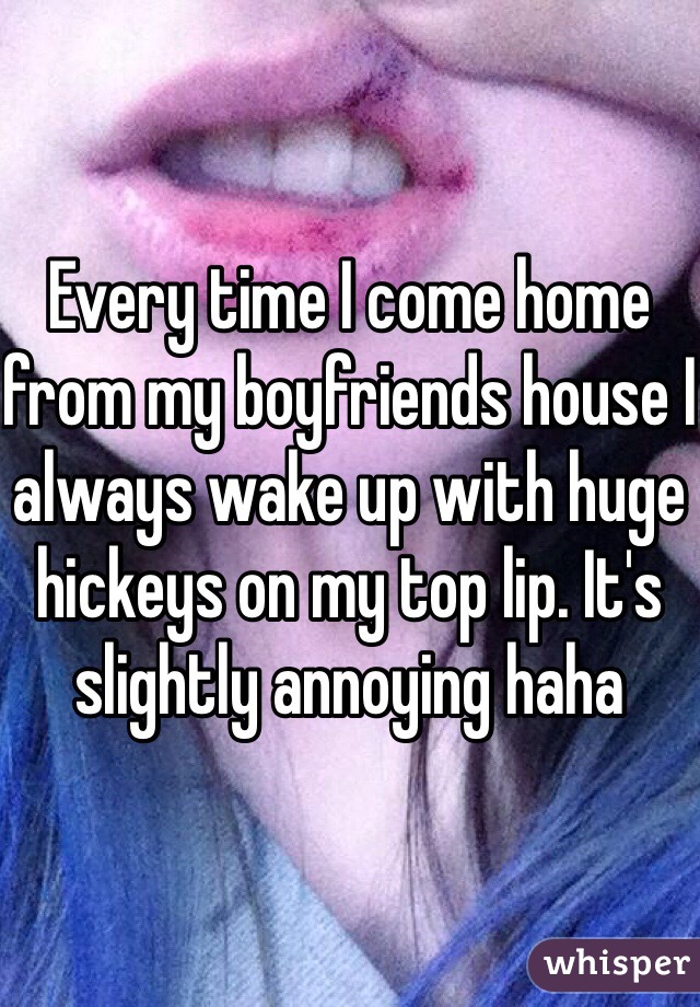 Every time I come home from my boyfriends house I always wake up with huge hickeys on my top lip. It's slightly annoying haha