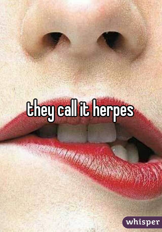 they call it herpes