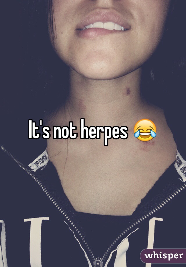 It's not herpes 😂