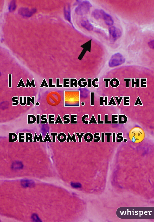 I am allergic to the sun. 🚫🌅. I have a disease called dermatomyositis.😢