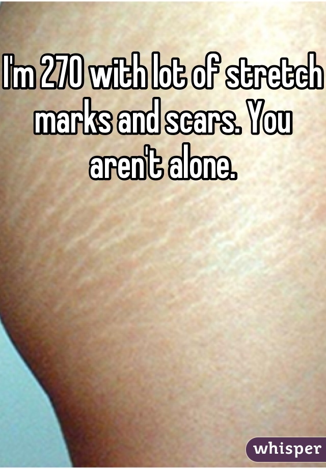 I'm 270 with lot of stretch marks and scars. You aren't alone.