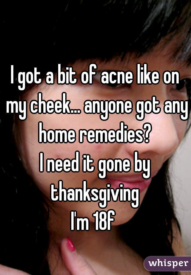 I got a bit of acne like on my cheek... anyone got any home remedies? 
I need it gone by thanksgiving 
I'm 18f 