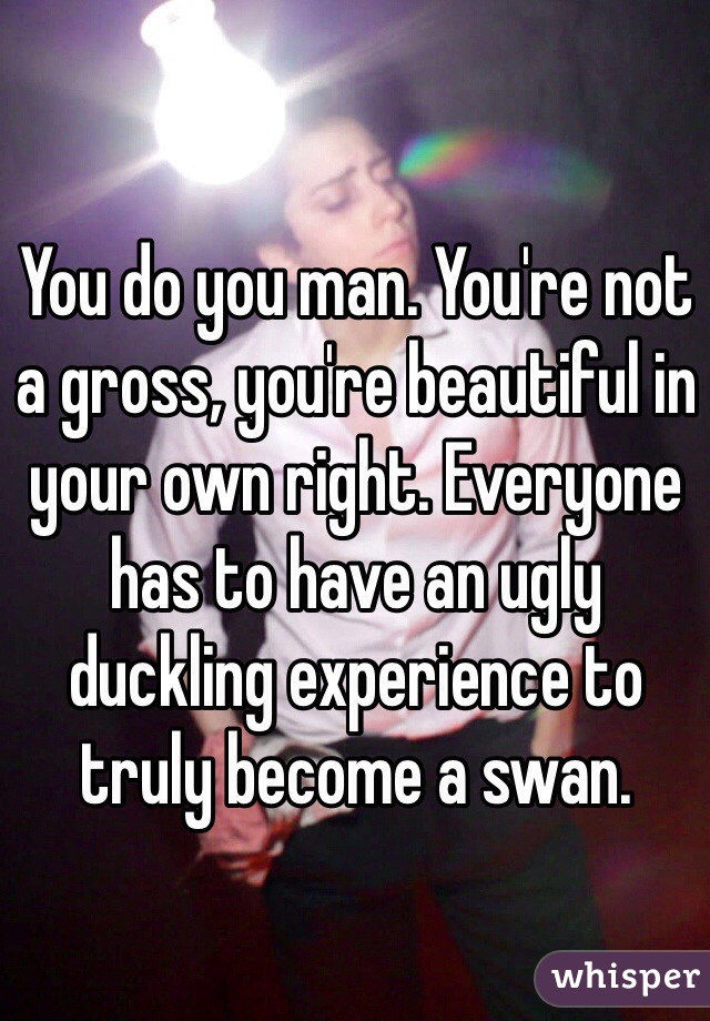 You do you man. You're not a gross, you're beautiful in your own right. Everyone has to have an ugly duckling experience to truly become a swan.