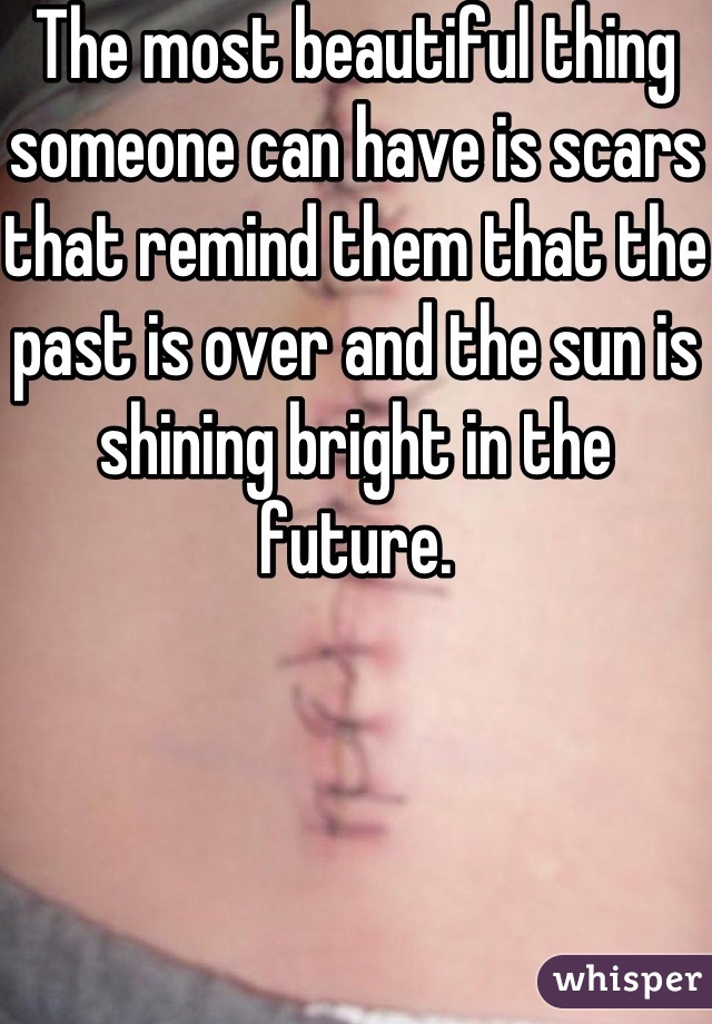 The most beautiful thing someone can have is scars that remind them that the past is over and the sun is shining bright in the future.