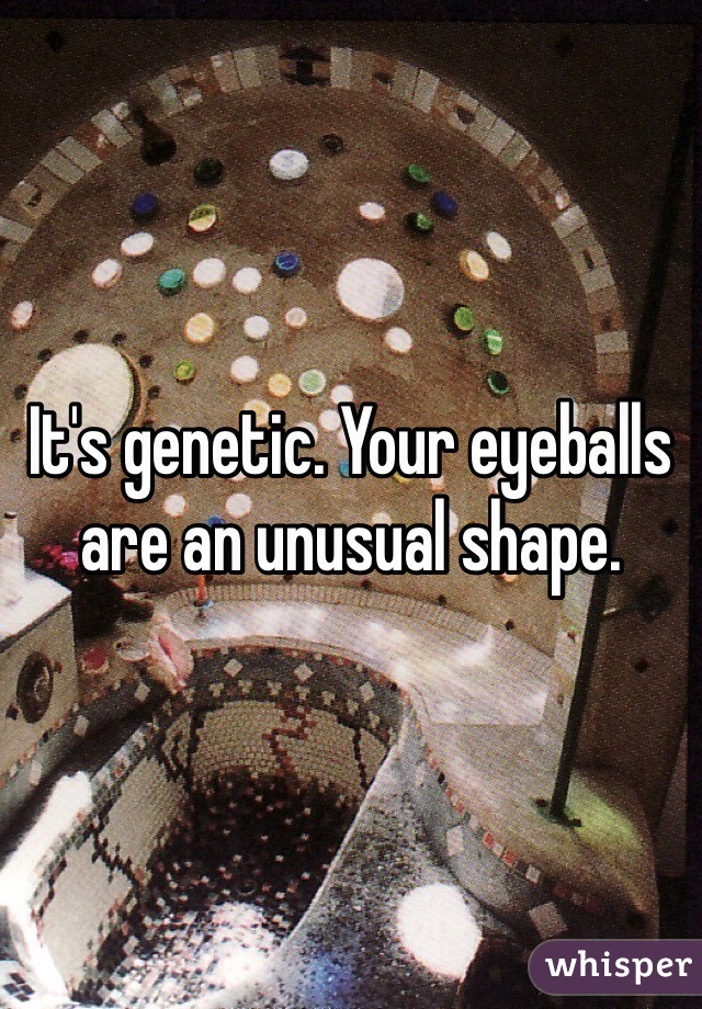 It's genetic. Your eyeballs are an unusual shape. 