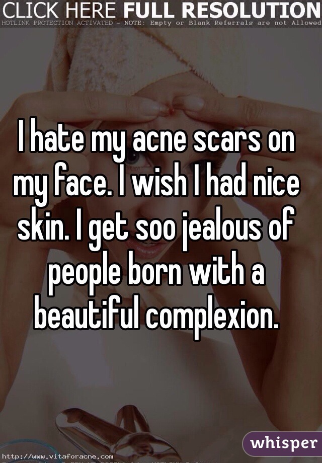 I hate my acne scars on my face. I wish I had nice skin. I get soo jealous of people born with a beautiful complexion. 