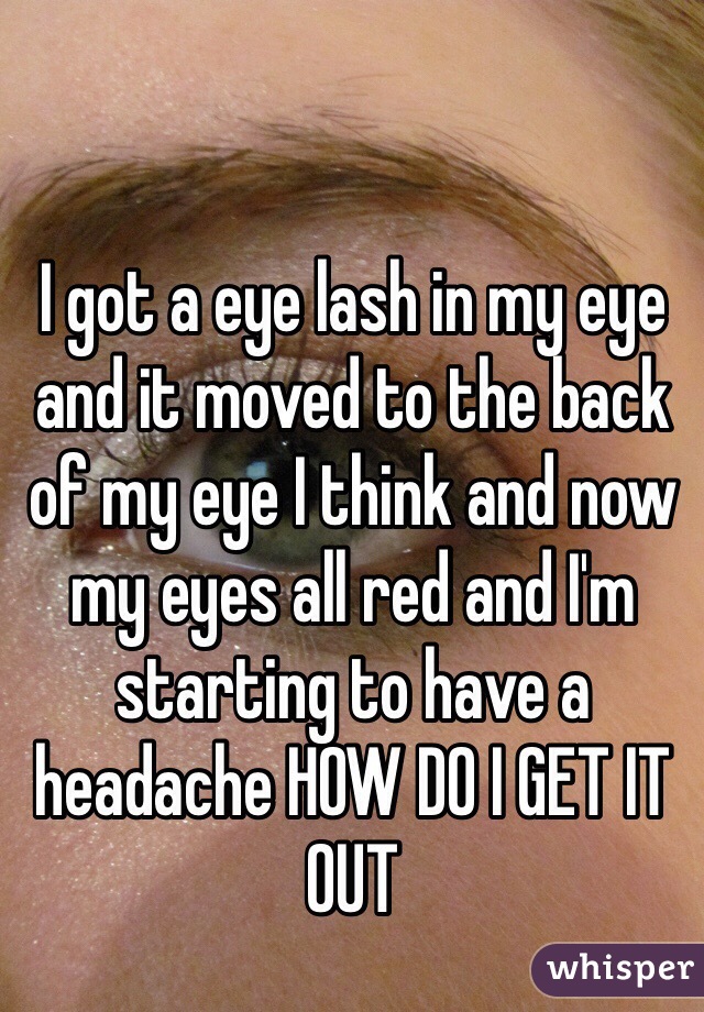 I got a eye lash in my eye and it moved to the back of my eye I think and now my eyes all red and I'm starting to have a headache HOW DO I GET IT OUT 