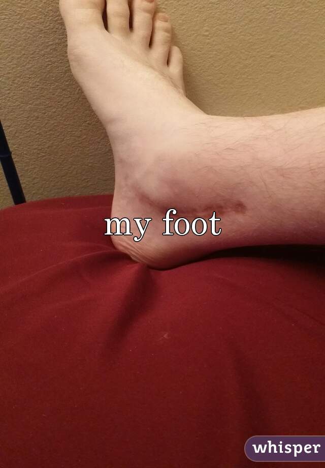 my foot