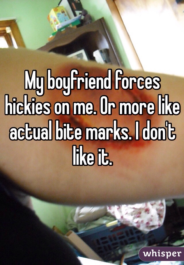 My boyfriend forces hickies on me. Or more like actual bite marks. I don't like it.