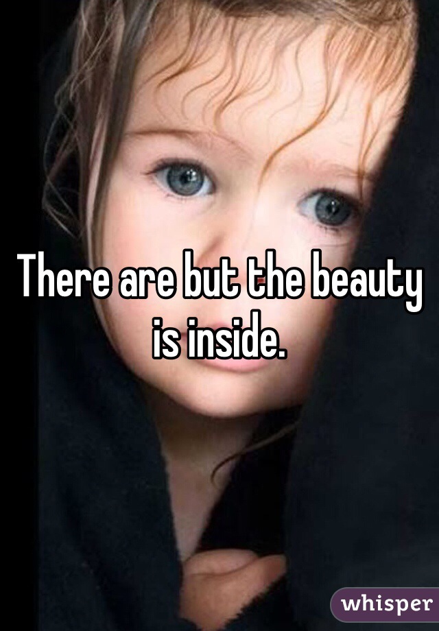 There are but the beauty is inside.