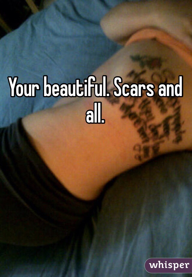 Your beautiful. Scars and all. 
