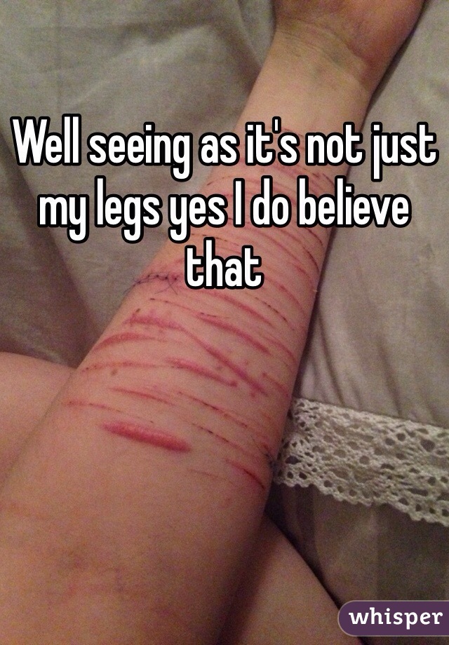 Well seeing as it's not just my legs yes I do believe that 