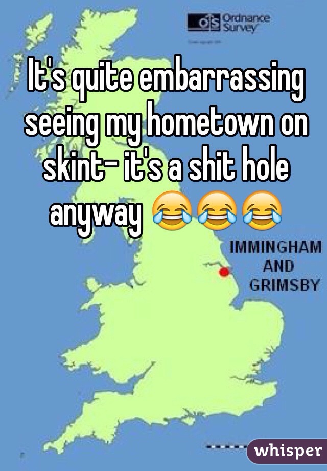 It's quite embarrassing seeing my hometown on skint- it's a shit hole anyway 😂😂😂