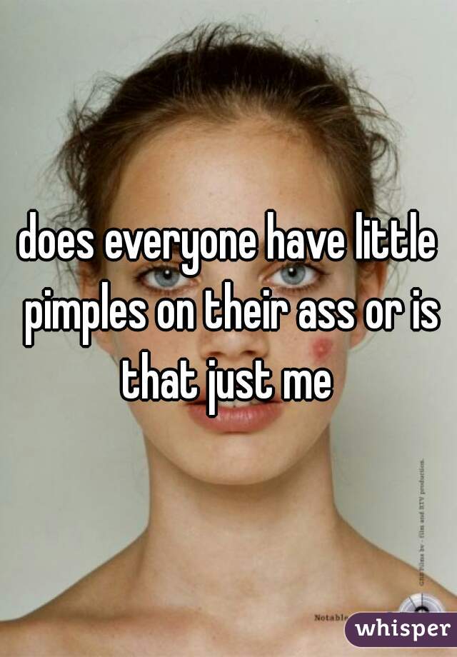 does everyone have little pimples on their ass or is that just me 