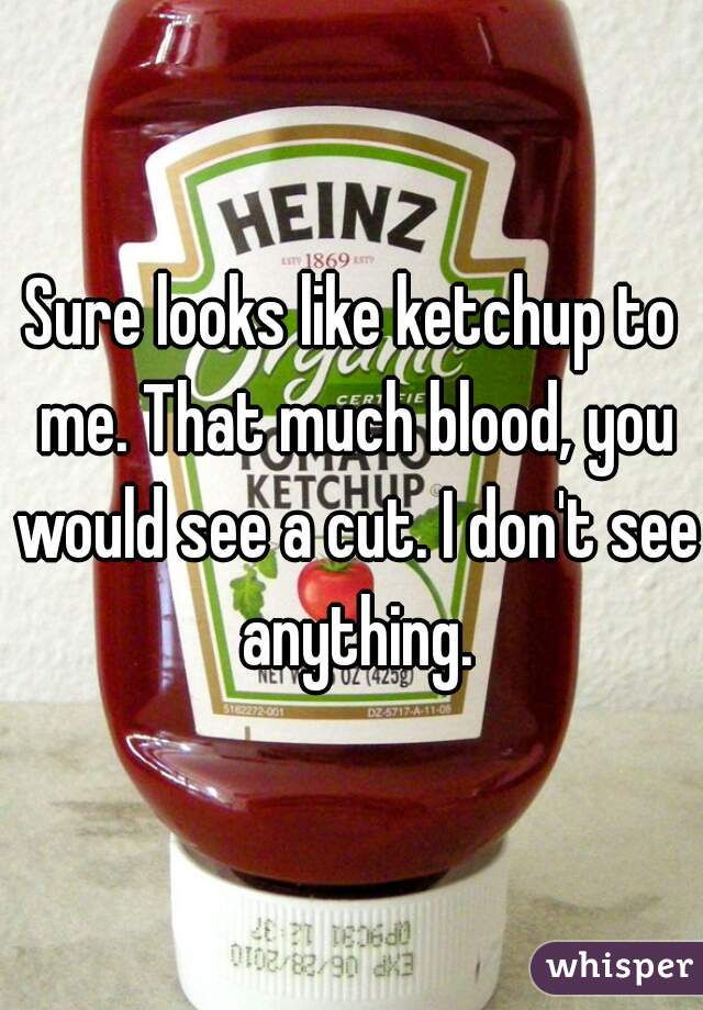 Sure looks like ketchup to me. That much blood, you would see a cut. I don't see anything.