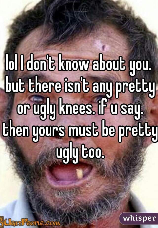 lol I don't know about you. but there isn't any pretty or ugly knees. if u say. then yours must be pretty ugly too.