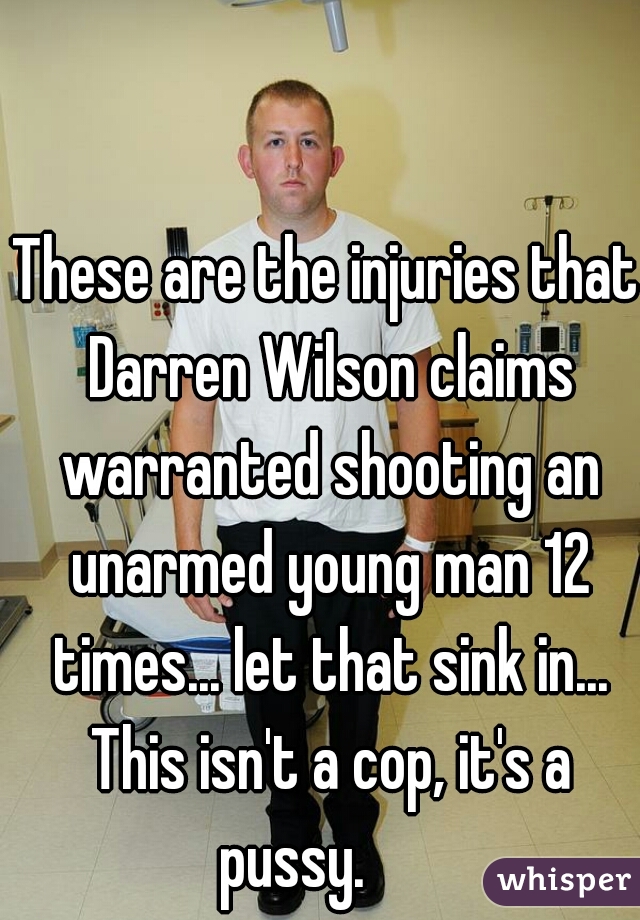 These are the injuries that Darren Wilson claims warranted shooting an unarmed young man 12 times... let that sink in... This isn't a cop, it's a pussy.      