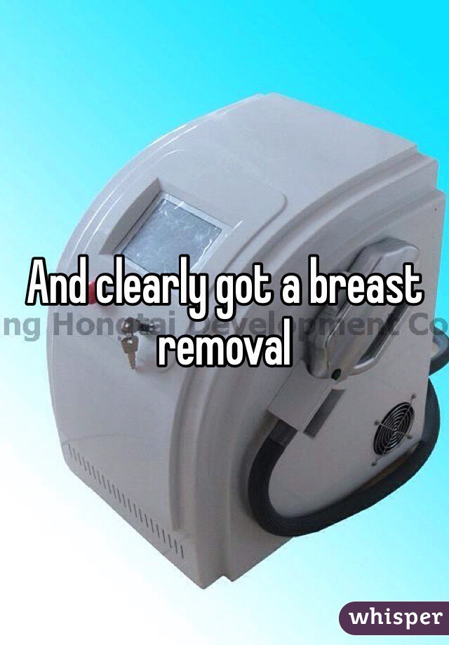 And clearly got a breast removal 