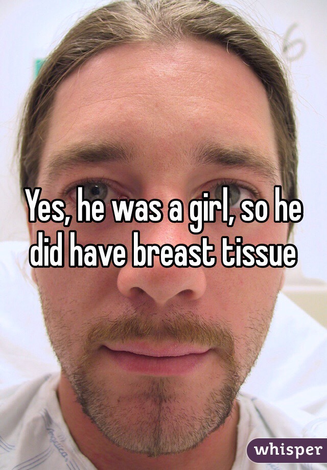 Yes, he was a girl, so he did have breast tissue 