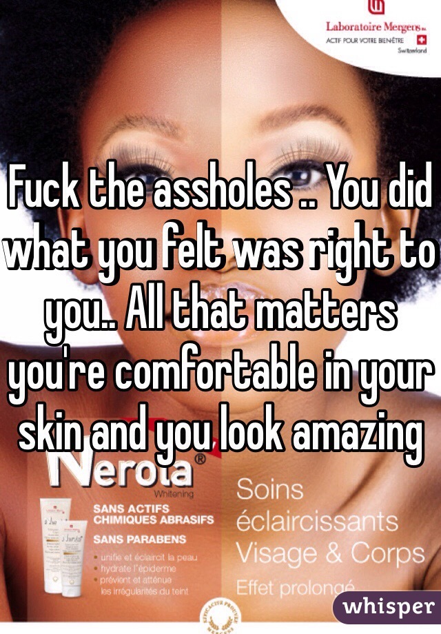 Fuck the assholes .. You did what you felt was right to you.. All that matters you're comfortable in your skin and you look amazing 