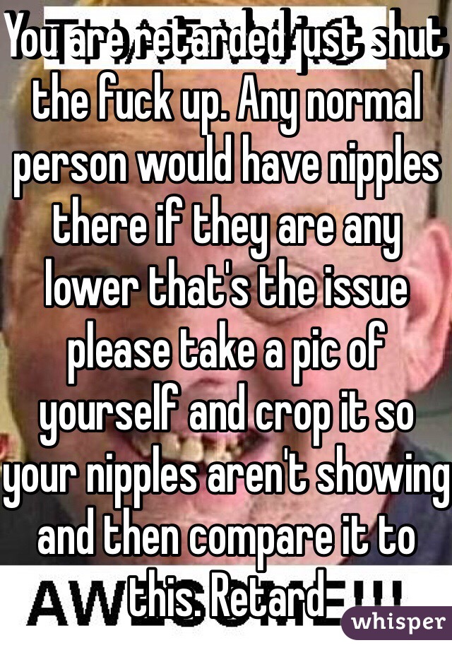 You are retarded just shut the fuck up. Any normal person would have nipples there if they are any lower that's the issue please take a pic of yourself and crop it so your nipples aren't showing and then compare it to this. Retard 