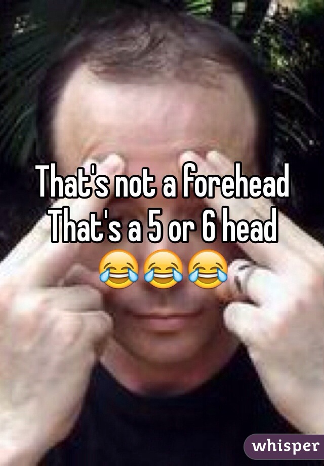 That's not a forehead 
That's a 5 or 6 head
😂😂😂