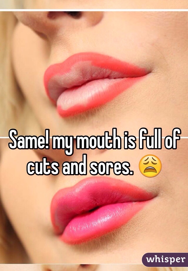 Same! my mouth is full of cuts and sores. 😩