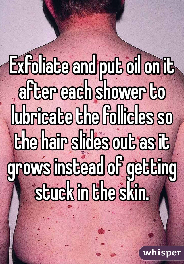 Exfoliate and put oil on it after each shower to lubricate the follicles so the hair slides out as it grows instead of getting stuck in the skin. 