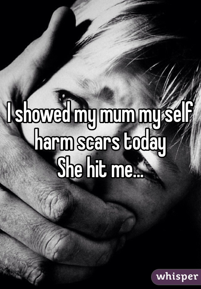 I showed my mum my self harm scars today
She hit me...