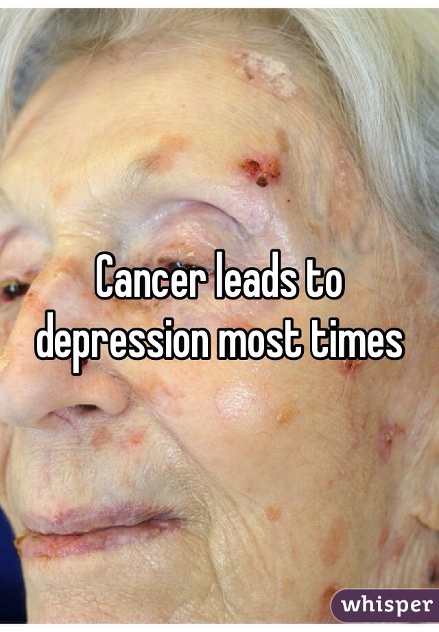 Cancer leads to depression most times